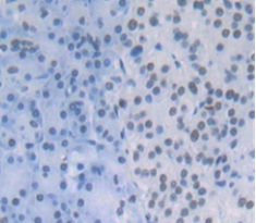 Polyclonal Antibody to Cleavage And Polyadenylation Specific Factor 1 (CPSF1)