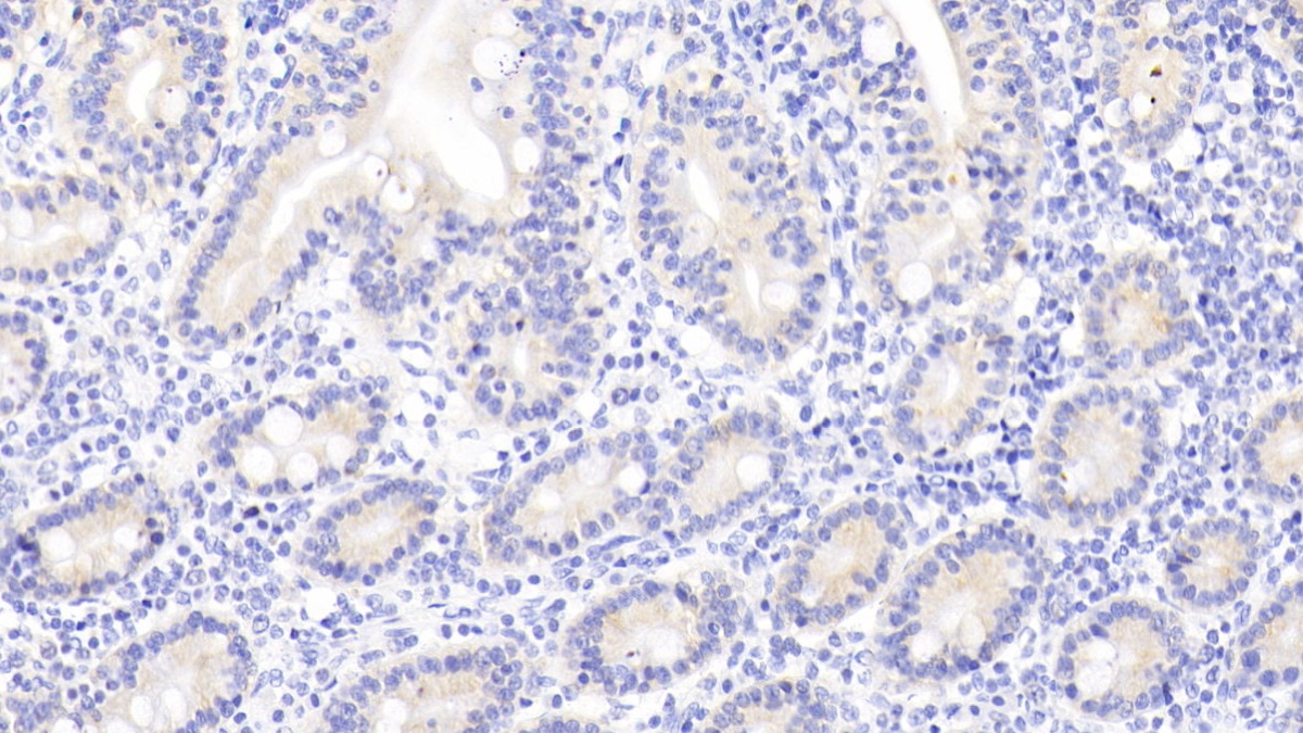 Polyclonal Antibody to RAB1A, Member RAS Oncogene Family (RAB1A)
