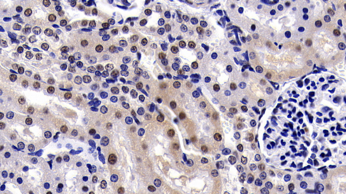 Polyclonal Antibody to Parkinson Disease Protein 2 (PARK2)