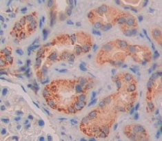Polyclonal Antibody to Niemann Pick Disease Type C2 (NPC2)