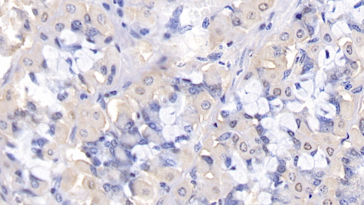 Polyclonal Antibody to B-Cell CLL/Lymphoma 2 Like Protein 2 (Bcl2L2)