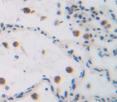 Polyclonal Antibody to Growth Arrest And DNA Damage Inducible Protein Alpha (GADD45a)