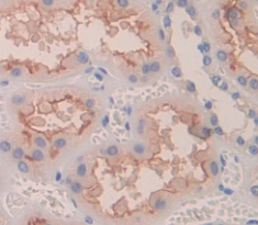Polyclonal Antibody to Neurofascin (NFASC)