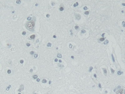 Polyclonal Antibody to Pygopus Homolog 2 (PYGO2)