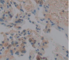 Polyclonal Antibody to V-Ral Simian Leukemia Viral Oncogene Homolog A (RALA)