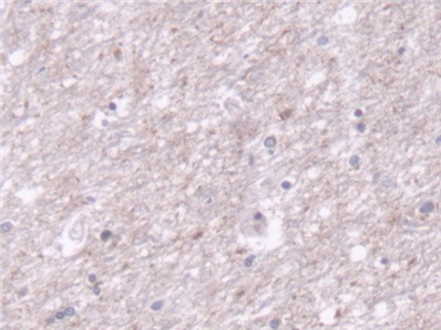 Polyclonal Antibody to Translocase Of Outer Mitochondrial Membrane 70A (TOMM70A)