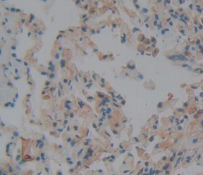 Polyclonal Antibody to Neuroblastoma, Suppression Of Tumorigenicity 1 (NBL1)
