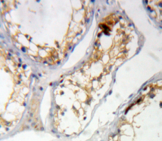 Polyclonal Antibody to Cancerous Inhibitor Of PP2A (CIP2A)