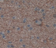 Polyclonal Antibody to SCAN Domain Containing Protein 3 (SCAND3)