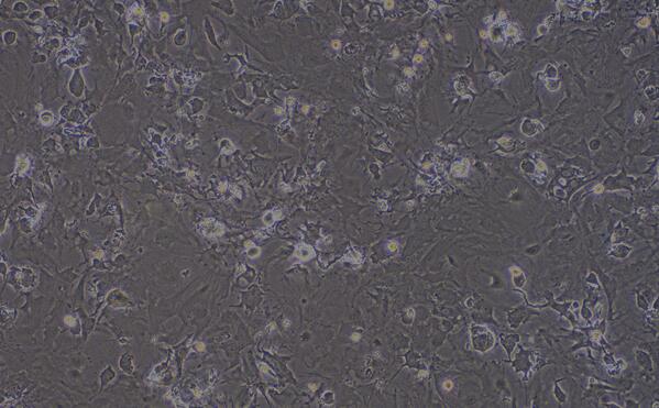 Primary Mouse Myocardial Cells (MC)