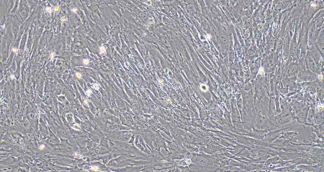 Primary Mouse Uterine Smooth Muscle Cells (USMC)