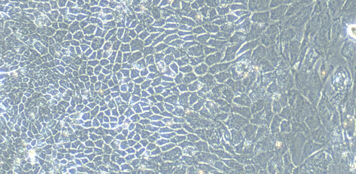 Primary Mouse Esophageal Epithelial Cells (EEC)