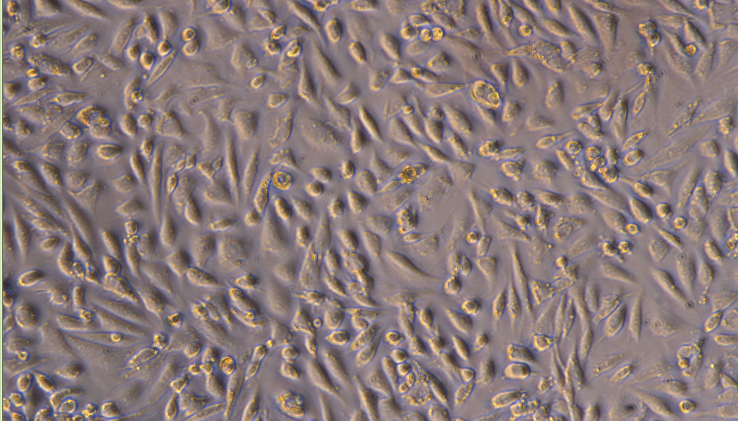 Primary Mouse Ovarian Surface Epithelial Cells (OSEC)