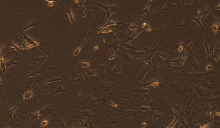 Primary Mouse Pericardial Fibroblasts (PF)