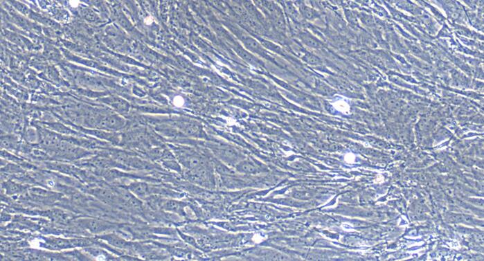 Primary Mouse Embryonic Fibroblasts (EF)