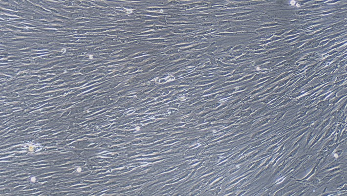 Primary Rabbit Peripheral Sciatic Nerve Fibroblasts ( PSNC)