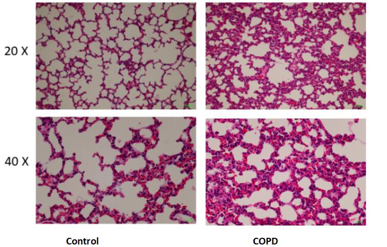 Mouse Model for Chronic Obstructive Pulmonary Disease (COPD)