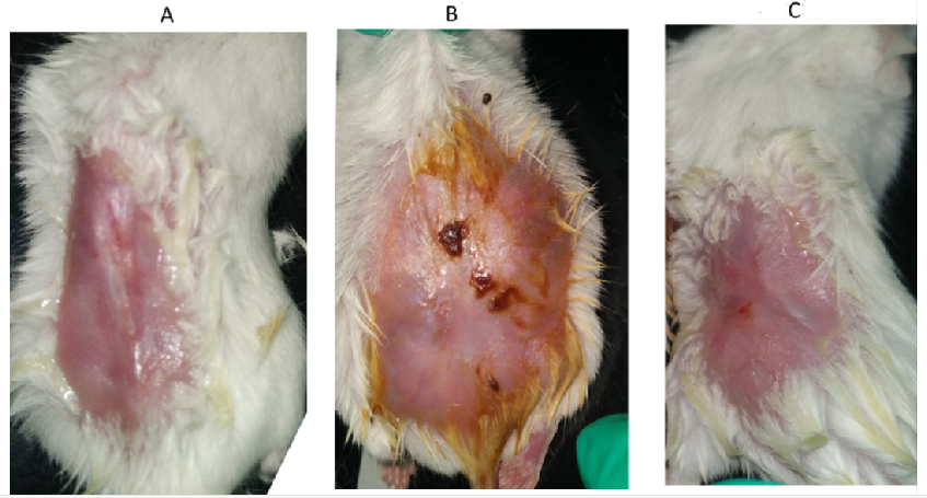 Mouse Model for Thermal Injury (TI)