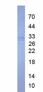 Eukaryotic High Mobility Group Protein 1 (HMGB1)