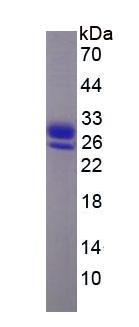 Eukaryotic Retinol Binding Protein 4 (RBP4)