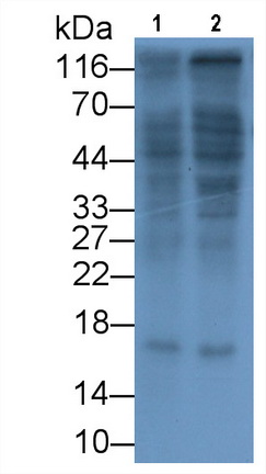 Monoclonal Antibody to Interleukin 17 (IL17)