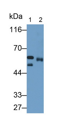 Monoclonal Antibody to Matrix Metalloproteinase 8 (MMP8)