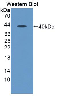 Monoclonal Antibody to Stromal Cell Derived Factor 1 (SDF1)