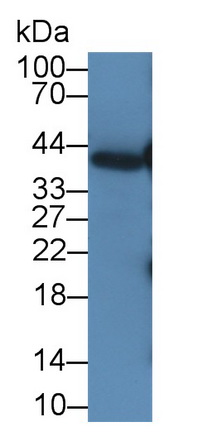 Monoclonal Antibody to Pepsinogen A (PGA)