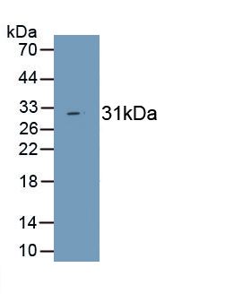 Monoclonal Antibody to GATA Binding Protein 3 (GATA3)