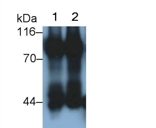 Monoclonal Antibody to Protein Kinase C Epsilon (PKCe)