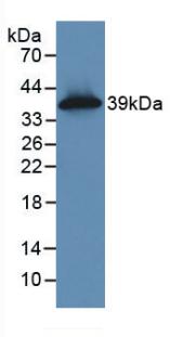 Monoclonal Antibody to Cytokeratin 16 (CK16)
