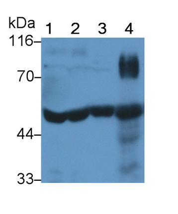 Monoclonal Antibody to Tissue Plasminogen Activator (tPA)