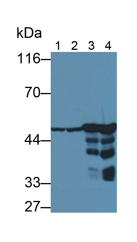 Monoclonal Antibody to Enolase, Neuron Specific (NSE)
