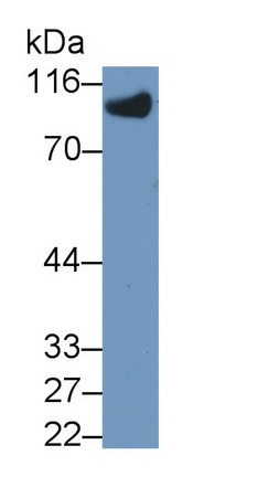 Monoclonal Antibody to Vascular Cell Adhesion Molecule 1 (VCAM1)