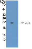Monoclonal Antibody to Cytokeratin 9 (CK9)