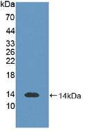 Monoclonal Antibody to S100 Calcium Binding Protein B (S100B)