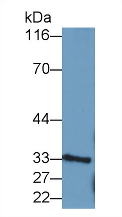 Monoclonal Antibody to Proliferating Cell Nuclear Antigen (PCNA)