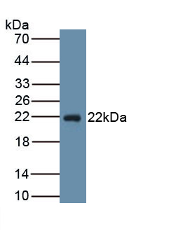 Monoclonal Antibody to Prostaglandin-H2 D-isomerase (PTGDS)