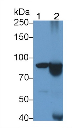 Monoclonal Antibody to Complement Receptor 2 (CD21)