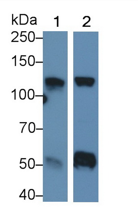 Monoclonal Antibody to Hexokinase 1 (HK1)