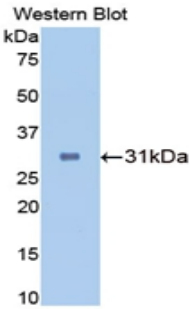 Monoclonal Antibody to Carbonic Anhydrase II (CA2)
