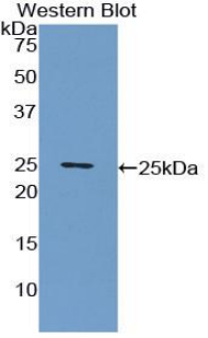 Biotin-Linked Monoclonal Antibody to C Reactive Protein (CRP)