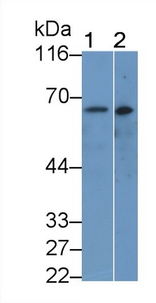 Monoclonal Antibody to Plasmin/Antiplasmin Complex (PAP)