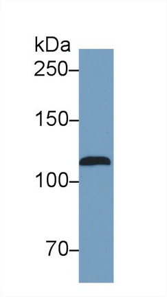 Monoclonal Antibody to Nitric Oxide Synthase 2, Inducible (NOS2)