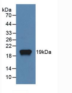 Monoclonal Antibody to Receptor Activator Of Nuclear Factor Kappa B Ligand (RANkL)