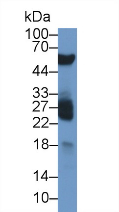 Monoclonal Antibody to Chemerin (CHEM)