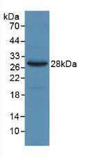 Monoclonal Antibody to Alpha-2-Macroglobulin (a2M)