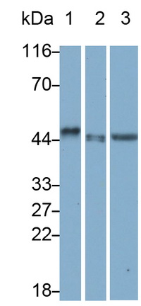 Monoclonal Antibody to Surfactant Associated Protein D (SPD)