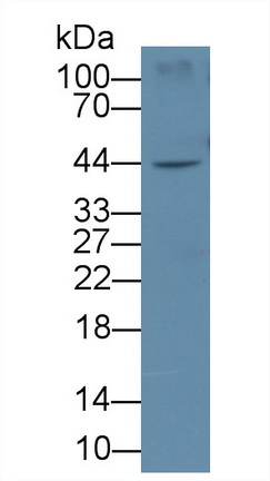 Monoclonal Antibody to Interleukin 19 (IL19)