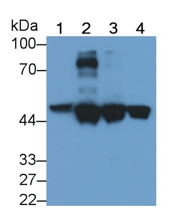 Monoclonal Antibody to Cytokeratin 18 (CK18)